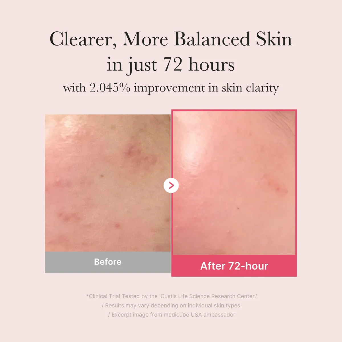Medicube TXA Niacinamide Serum — фото 4