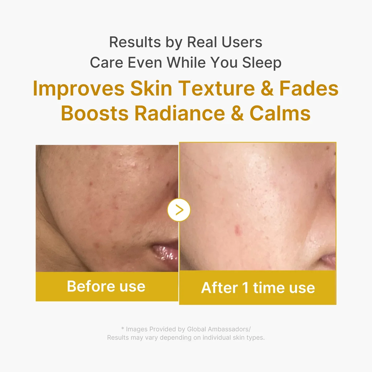 Medicube Kojic Acid Turmeric Overnight Wrapping Mask — фото 3
