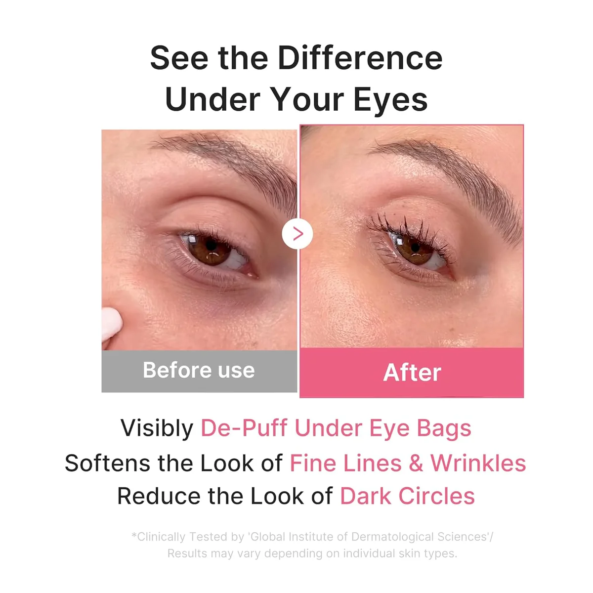Medicube PDRN Pink Jelly Eye Mask — фото 2